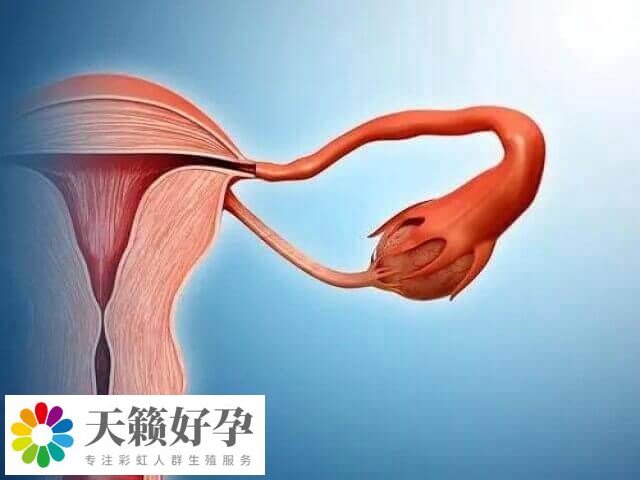 卵巢囊肿怎么怀孕生孩子