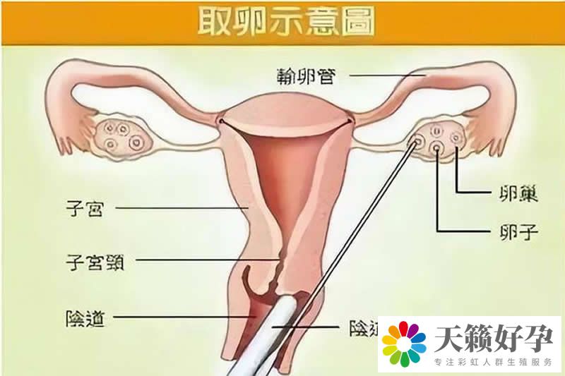 天锋试管